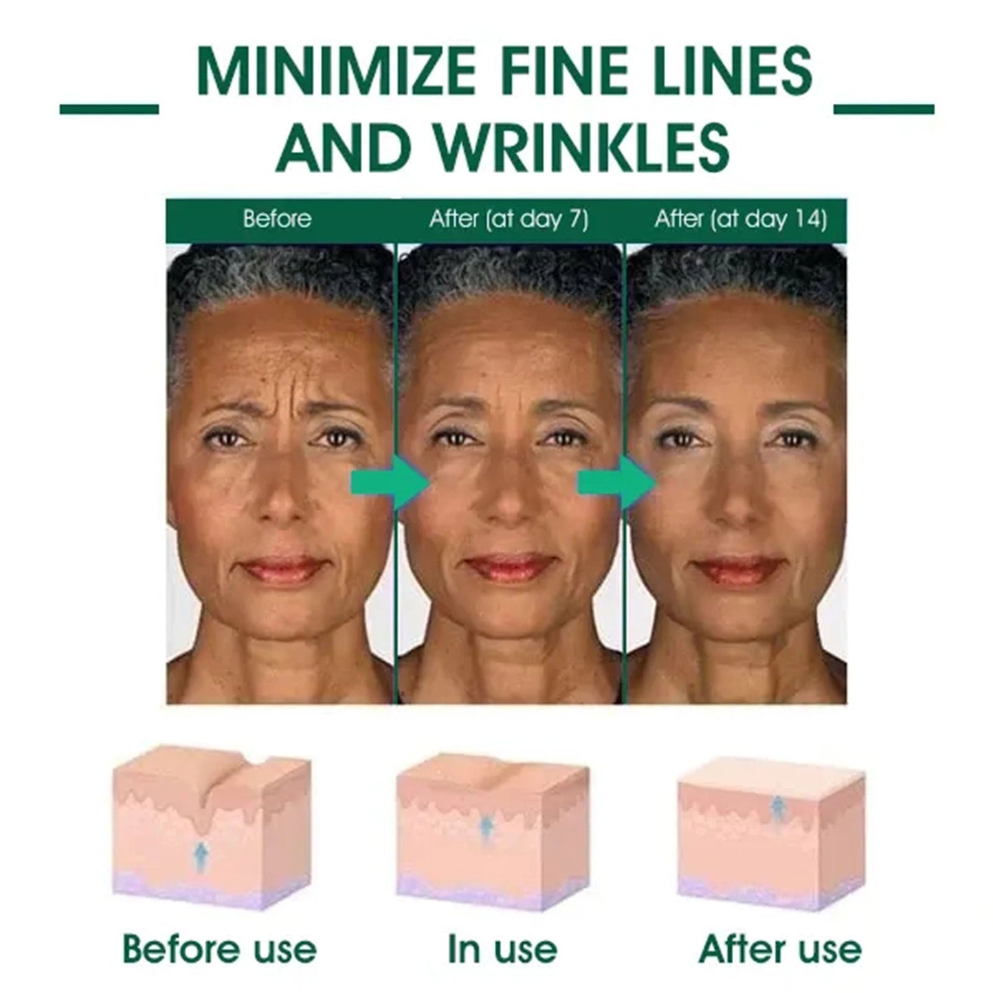 🔥👩⚕️Last Day Promotion 𝟕𝟎%𝐎𝐅𝐅 - Fuzero™ SkinFirming Rejuvenating Serum🔥