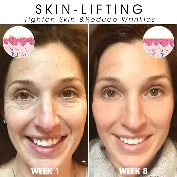 🔥👩⚕️Last Day Promotion 𝟕𝟎%𝐎𝐅𝐅 - Fuzero™ SkinFirming Rejuvenating Serum🔥