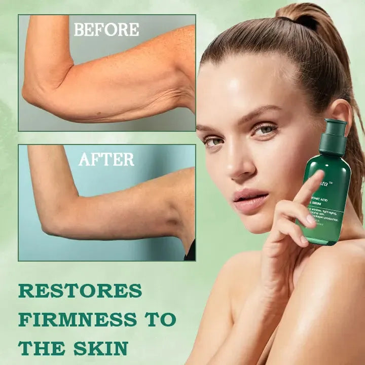 🔥👩⚕️Last Day Promotion 𝟕𝟎%𝐎𝐅𝐅 - Fuzero™ SkinFirming Rejuvenating Serum🔥