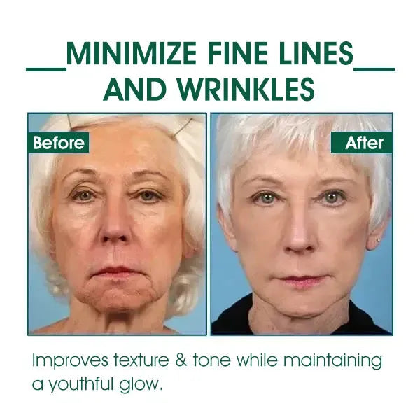 🔥👩⚕️Last Day Promotion 𝟕𝟎%𝐎𝐅𝐅 - Fuzero™ SkinFirming Rejuvenating Serum🔥