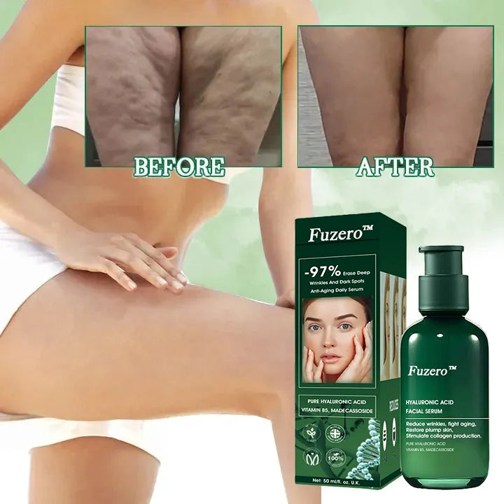 🔥👩⚕️Last Day Promotion 𝟕𝟎%𝐎𝐅𝐅 - Fuzero™ SkinFirming Rejuvenating Serum🔥