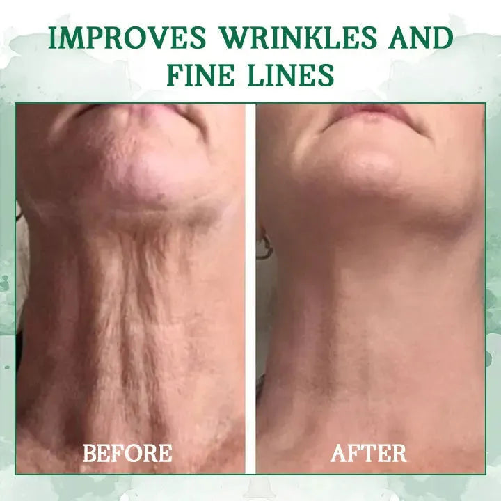🔥👩⚕️Last Day Promotion 𝟕𝟎%𝐎𝐅𝐅 - Fuzero™ SkinFirming Rejuvenating Serum🔥