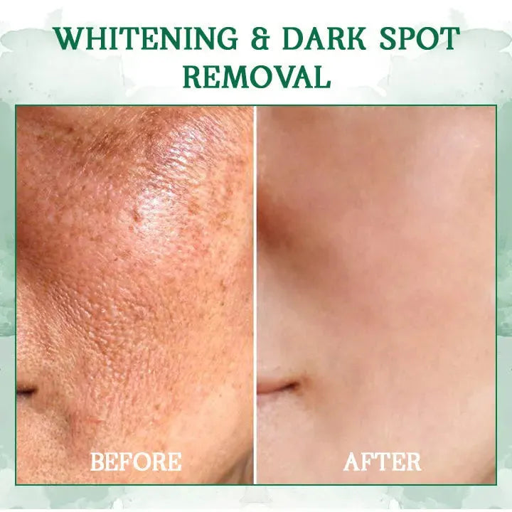 🔥👩⚕️Last Day Promotion 𝟕𝟎%𝐎𝐅𝐅 - Fuzero™ SkinFirming Rejuvenating Serum🔥