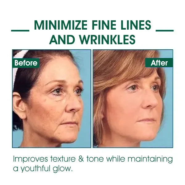 🔥👩⚕️Last Day Promotion 𝟕𝟎%𝐎𝐅𝐅 - Fuzero™ SkinFirming Rejuvenating Serum🔥