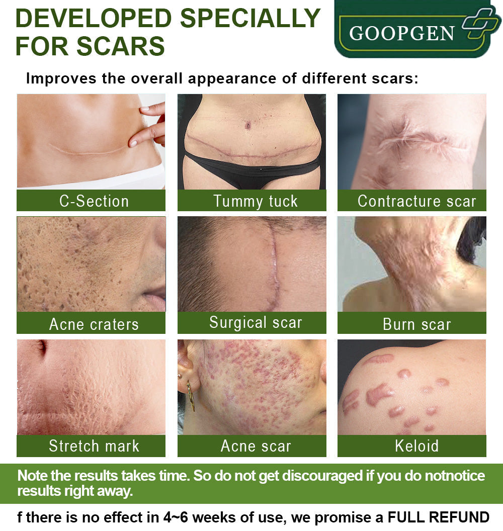 flysmus™ Advanced Scar Repair Serum