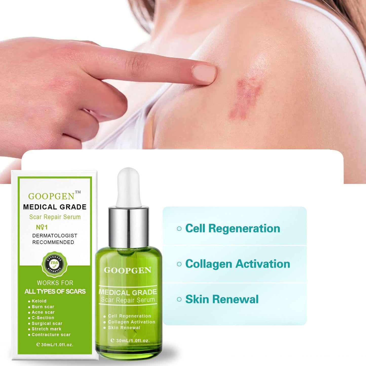 flysmus™ Advanced Scar Repair Serum