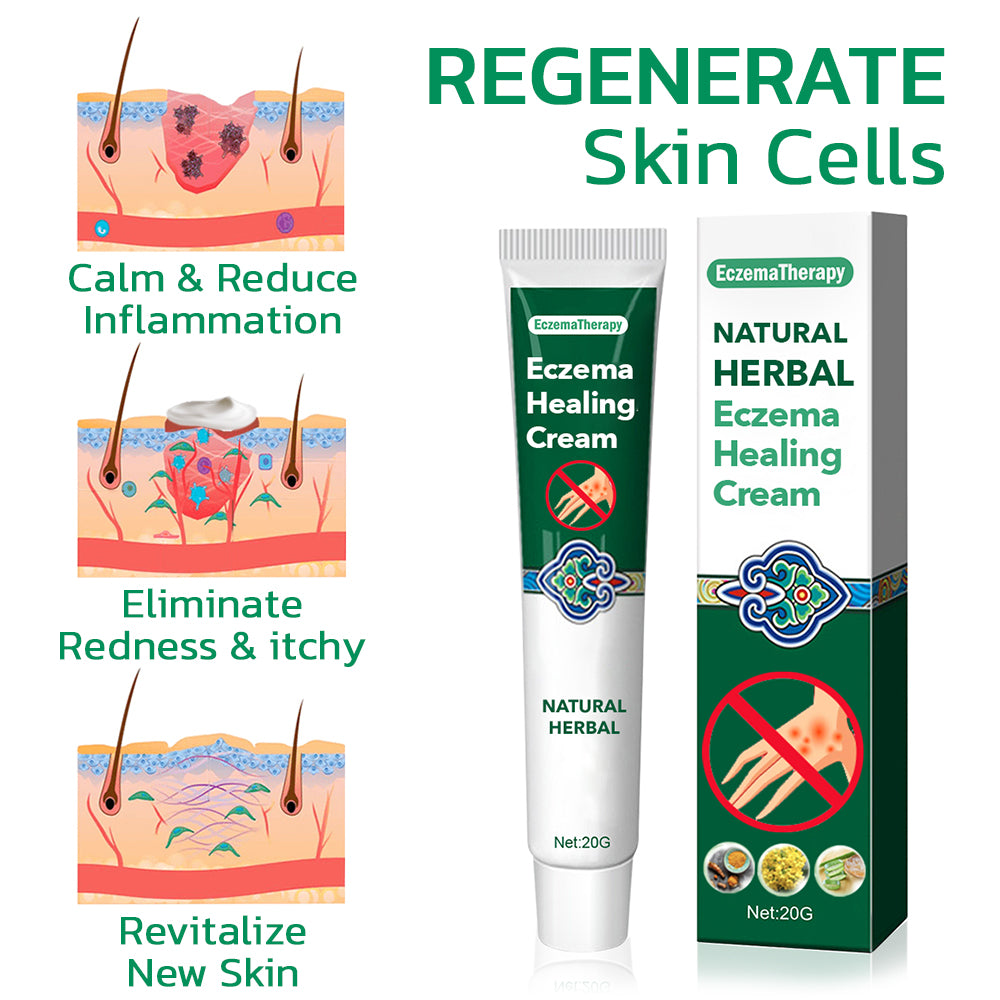 EczemaTherapy Herbal Hydration Cream