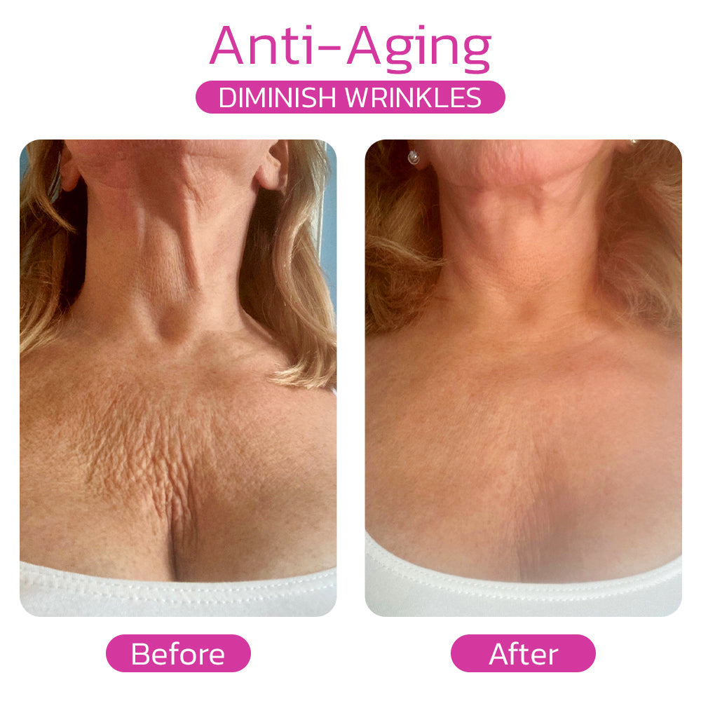 Eilisra Xhekpon Hydrolized Collagen And Aloe Vera Cream