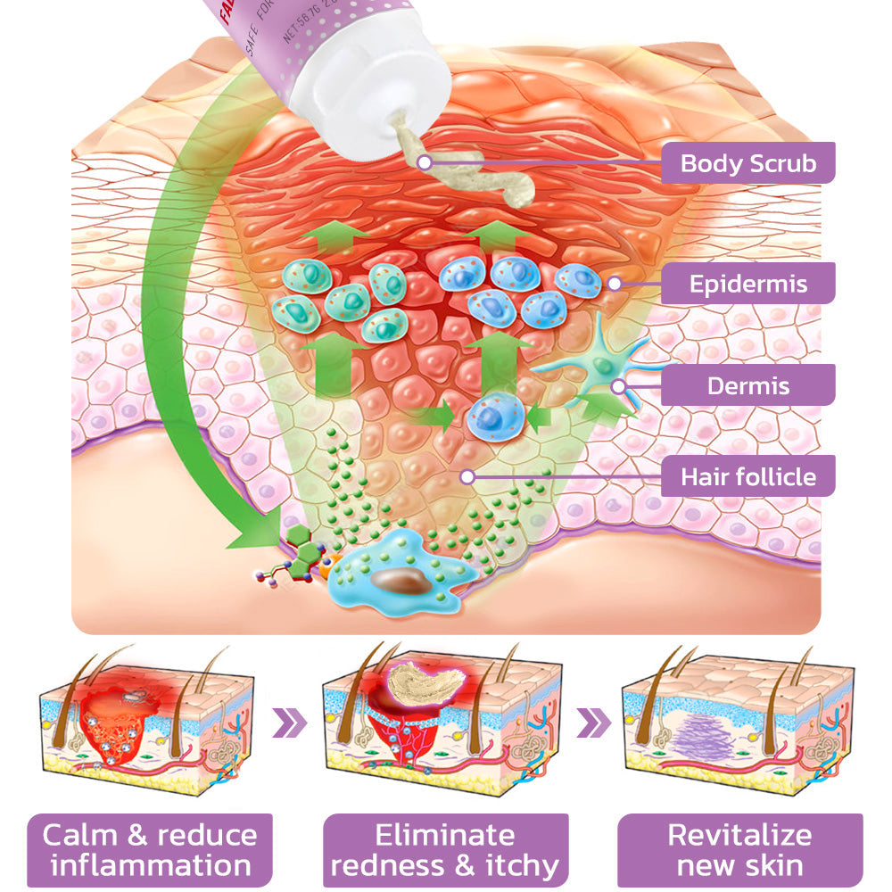 flysmus™ KP Keratosis Balance Eraser Body Scrub
