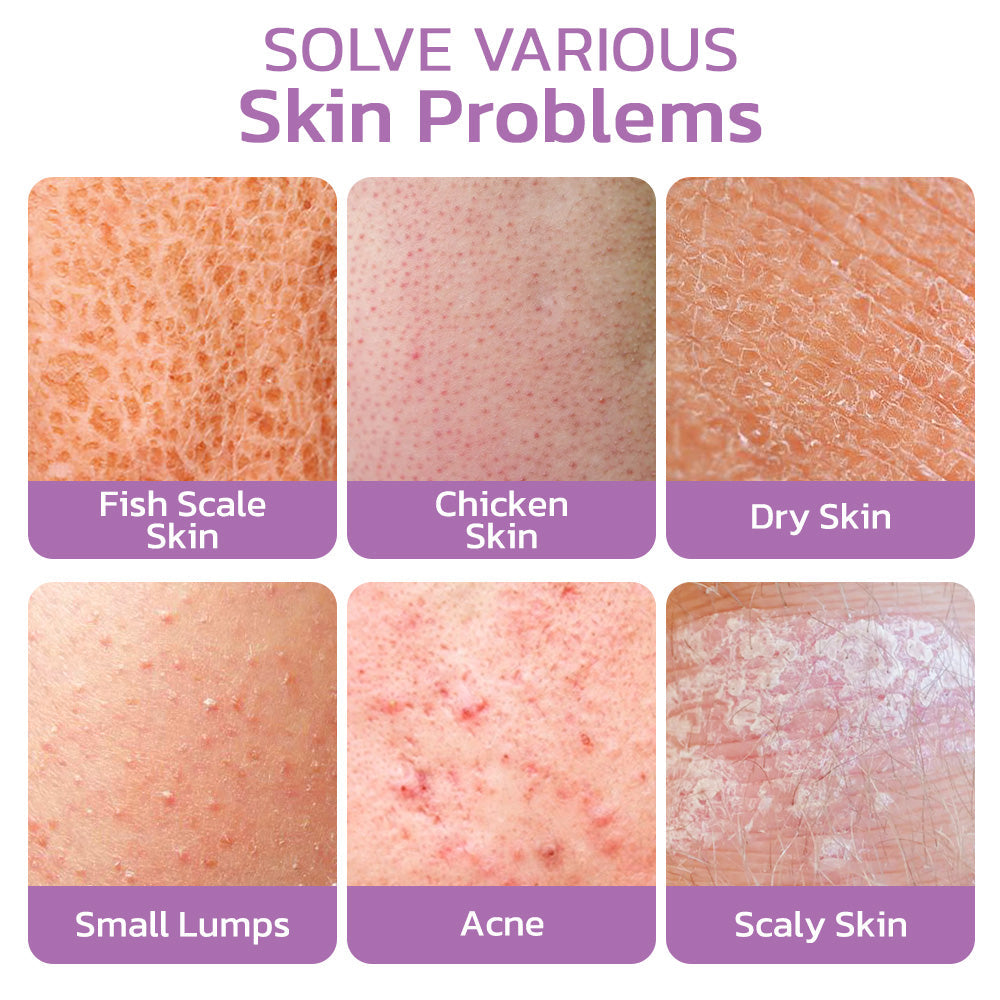 flysmus™ KP Keratosis Balance Eraser Body Scrub