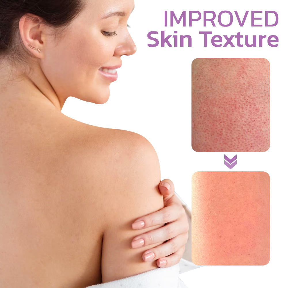 flysmus™ KP Keratosis Balance Eraser Body Scrub