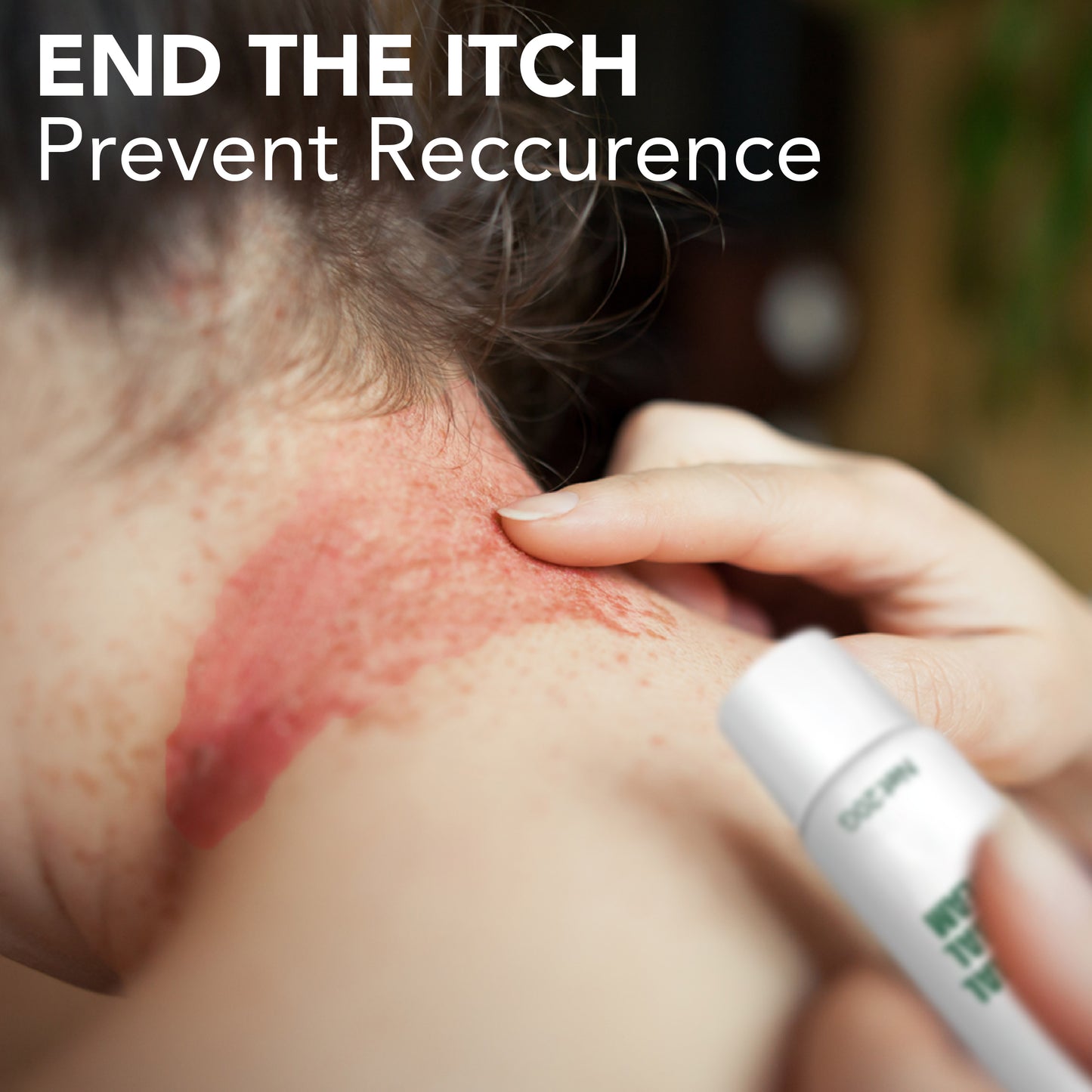 EczemaTherapy Herbal Hydration Cream