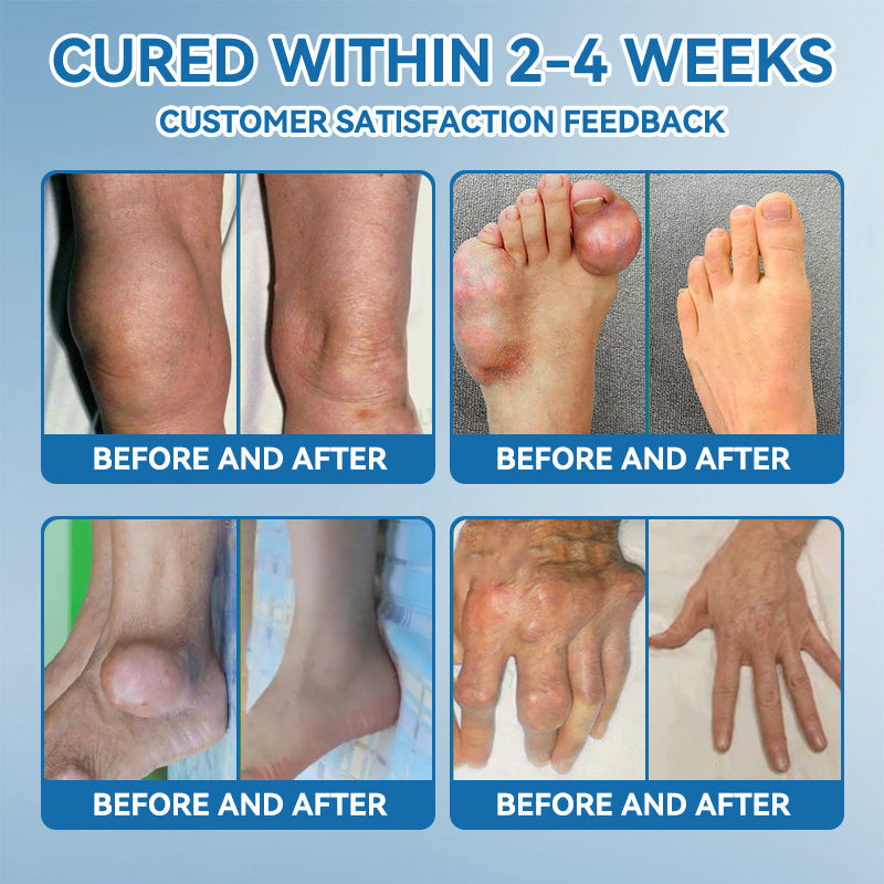 🇦🇺𝐟𝐥𝐲𝐬𝐦𝐮𝐬® 𝐁𝐏𝐂-𝟏𝟓𝟕 𝐉𝐨𝐢𝐧𝐭 𝐇𝐞𝐚𝐥𝐢𝐧𝐠 𝐂𝐫𝐞𝐚𝐦🦴Treats Arthritis, Neuropathy, Rheumatism, Sports Injuries & More🏆