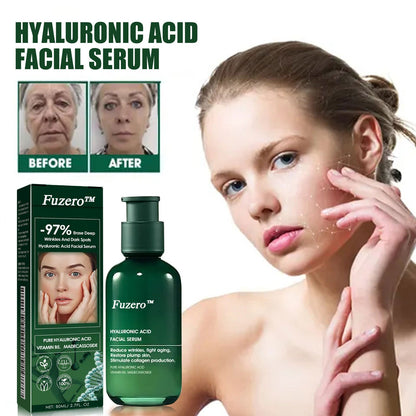 🔥👩‍⚕️Last Day Promotion 𝟕𝟎%𝐎𝐅𝐅 - Fuzero™ SkinFirming Rejuvenating Serum🔥