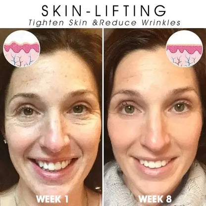 🔥👩‍⚕️Last Day Promotion 𝟕𝟎%𝐎𝐅𝐅 - Fuzero™ SkinFirming Rejuvenating Serum🔥