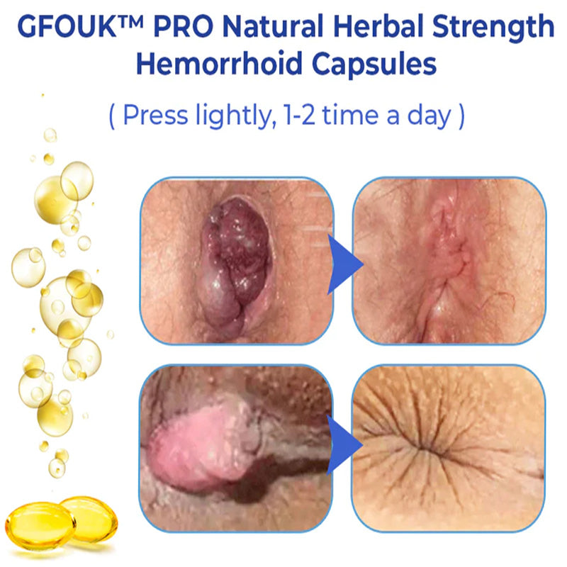 GFOUK™ PRO Natural Herbal Strength Hemorrhoid Capsules