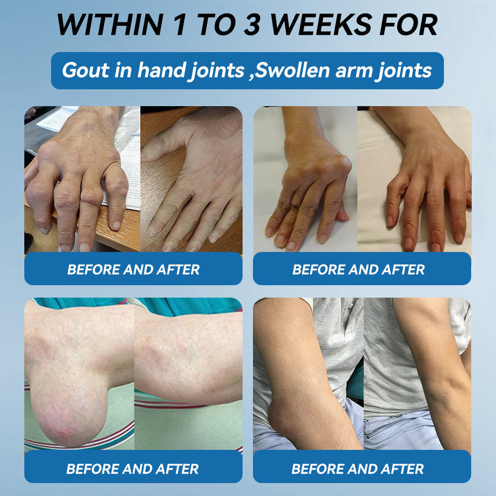 🇦🇺𝐟𝐥𝐲𝐬𝐦𝐮𝐬® 𝐁𝐏𝐂-𝟏𝟓𝟕 𝐉𝐨𝐢𝐧𝐭 𝐇𝐞𝐚𝐥𝐢𝐧𝐠 𝐂𝐫𝐞𝐚𝐦🦴Treats Arthritis, Neuropathy, Rheumatism, Sports Injuries & More🏆
