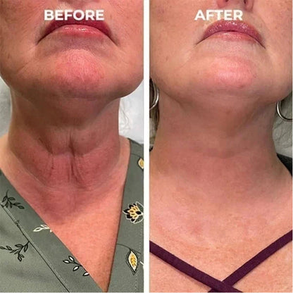 🔥👩‍⚕️Last Day Promotion 𝟕𝟎%𝐎𝐅𝐅 - Fuzero™ SkinFirming Rejuvenating Serum🔥