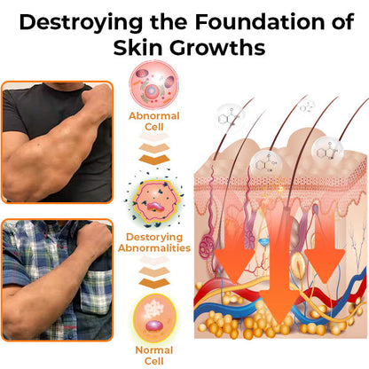 GFOUK™ MediSmooth Tags & Lumps Remove Gel