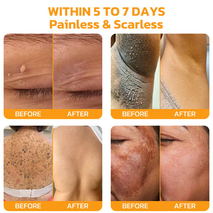 Furzero™ Bee Venom Skincare Treatment Pads (👩🏼⚕️AAD Recommended)