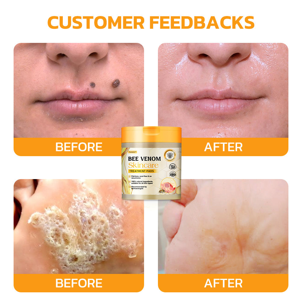 Furzero™ Bee Venom Skincare Treatment Pads (👩🏼⚕️AAD Recommended)