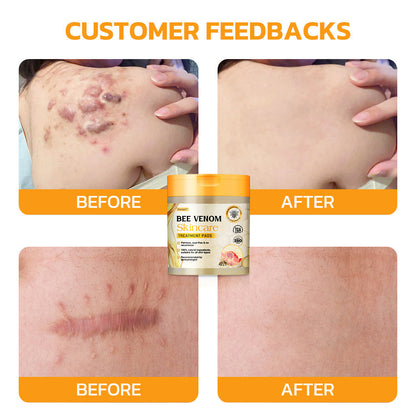 Furzero™ Bee Venom Skincare Treatment Pads (👩🏼⚕️AAD Recommended)