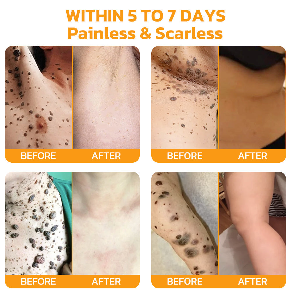 Furzero™ Bee Venom Skincare Treatment Pads (👩🏼⚕️AAD Recommended)