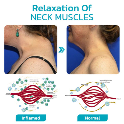 Furzero™ ChillNeck Ultrasonic Lymphatic Therapeutic Massager