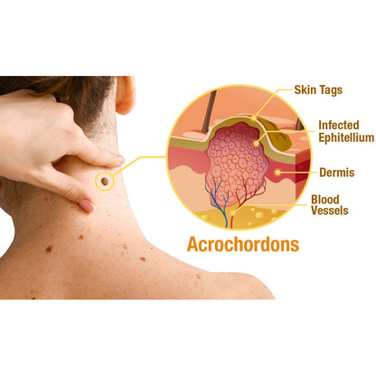 ✚flysmus™ TagRecede Bee Venom Treatment Spray