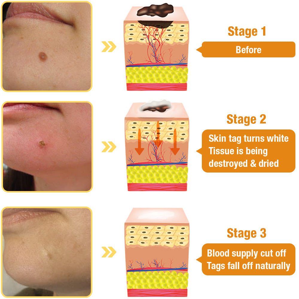 ✚flysmus™ TagRecede Bee Venom Treatment Spray