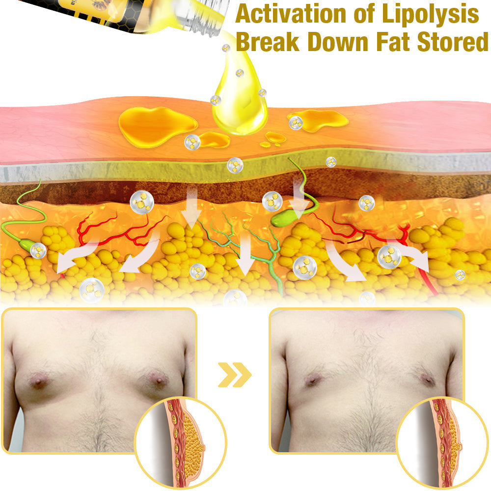 🌍GFOUK™ MenTherm Bee Venom Gynecomastia Heating Oil