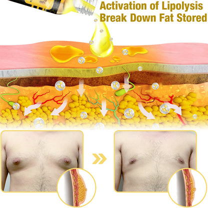 🌍GFOUK™ MenTherm Bee Venom Gynecomastia Heating Oil