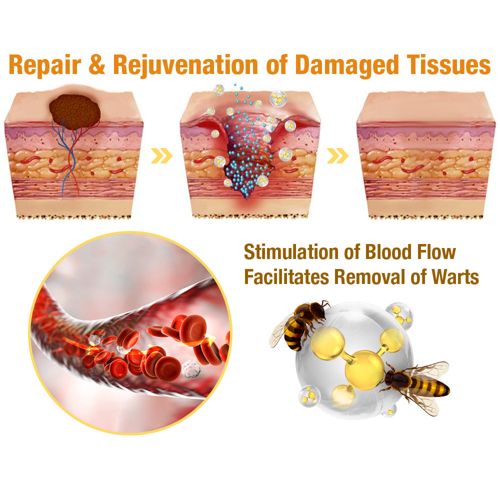 ✚flysmus™ TagRecede Bee Venom Treatment Spray