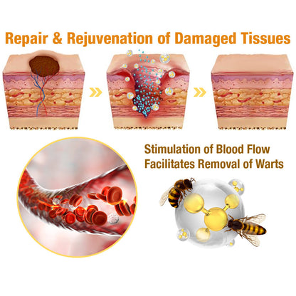 ✚flysmus™ TagRecede Bee Venom Treatment Spray