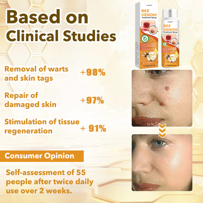 🐝Furzero™ Bee Venom Therapy Spray（✅Dermatest Certification）