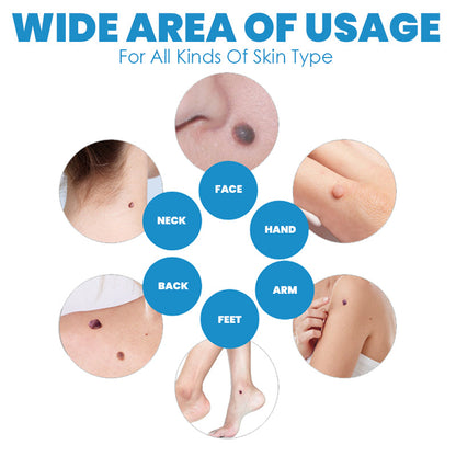 FibrOUT Auto Skin Tag Removal Kit