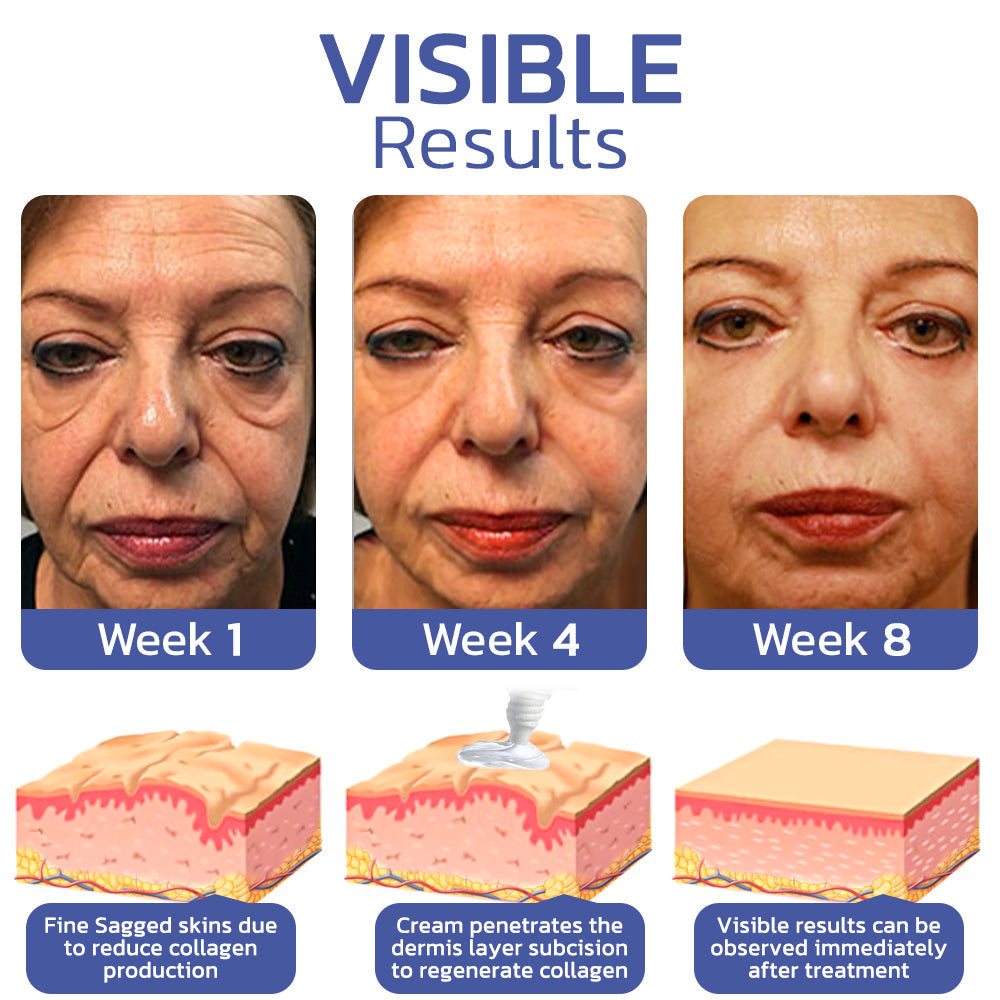 flysmus™ BIGEYES Lifting Eyelid Defining Cream