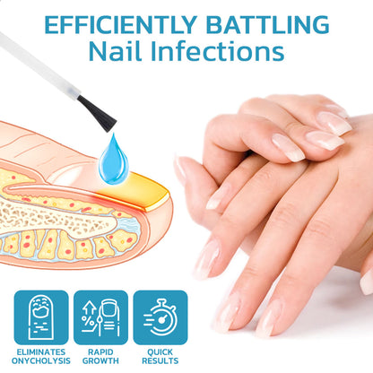 flysmus™ OnycholysisHeal Nail Strengthening And Growth Conditioner