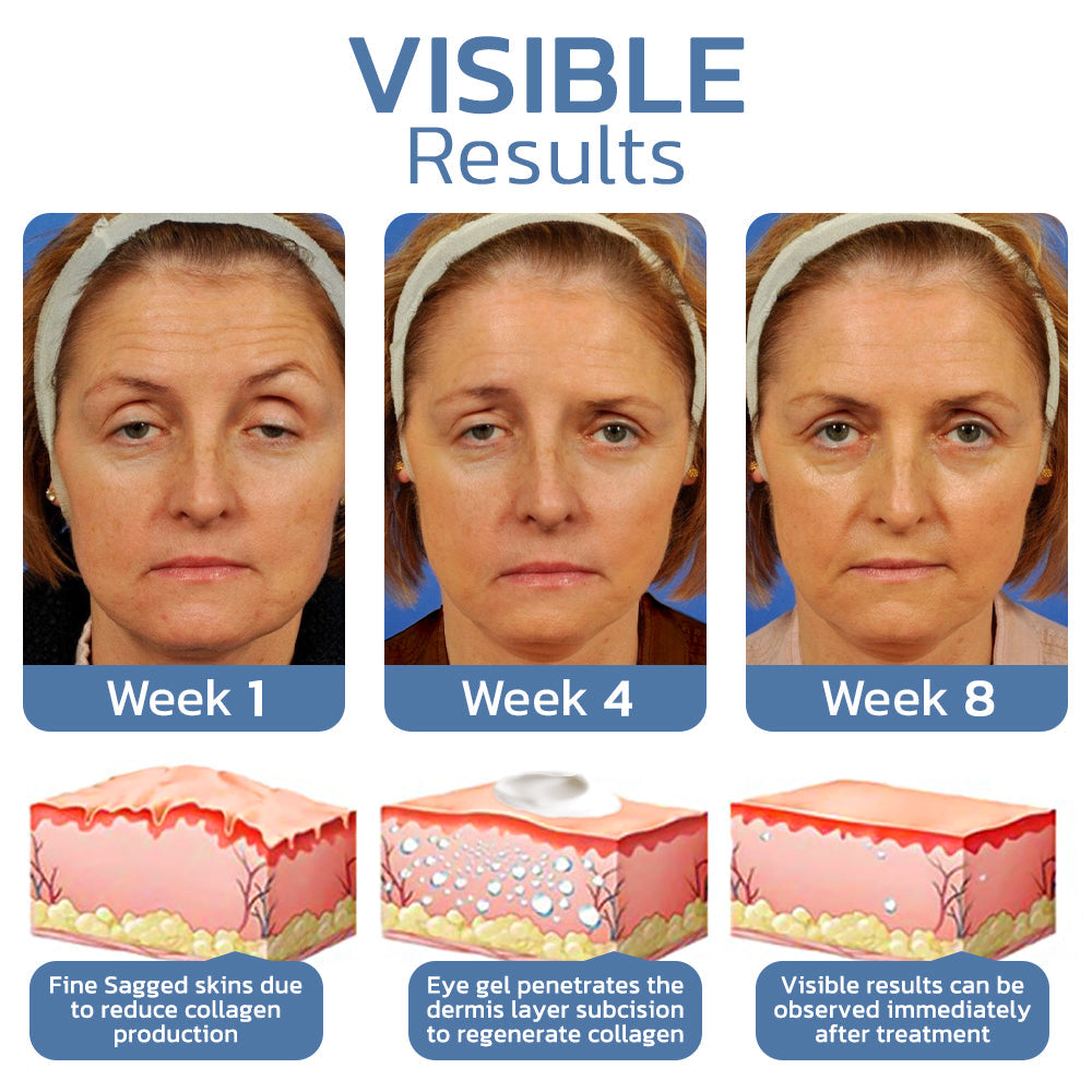 Flysmus™ OPENEYES Awaken Peptide Lifting Eye Gel