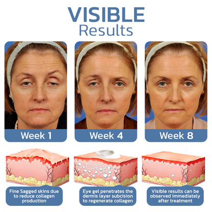Flysmus™ OPENEYES Awaken Peptide Lifting Eye Gel