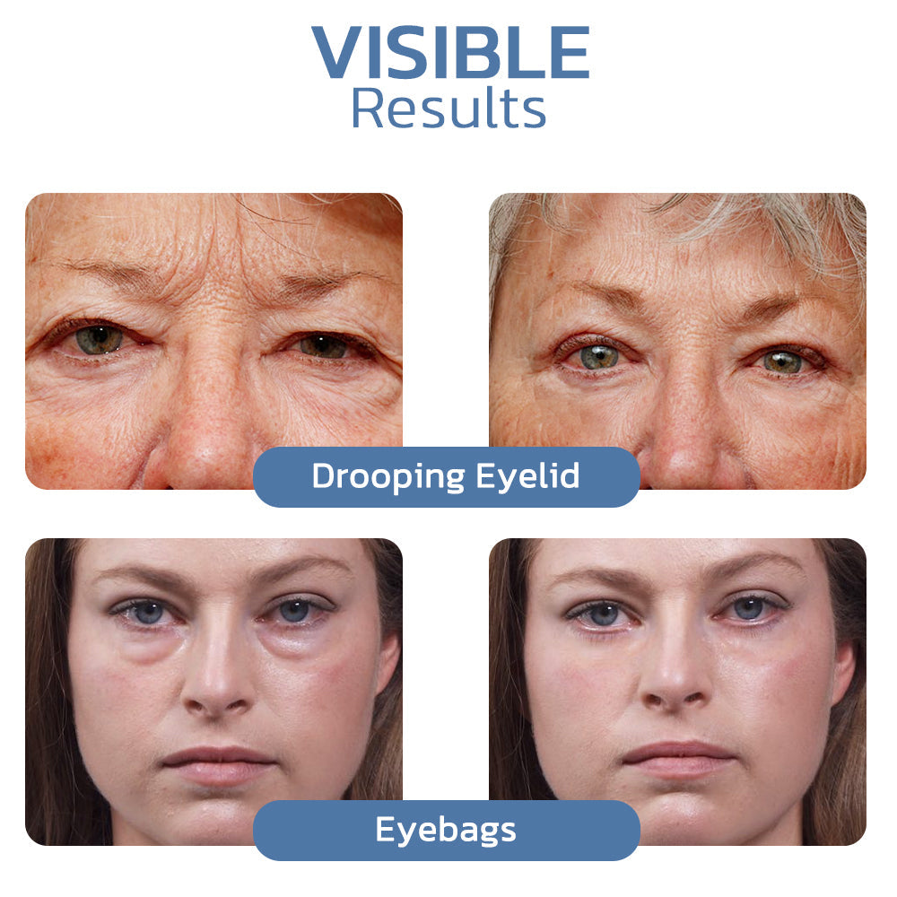 Flysmus™ OPENEYES Awaken Peptide Lifting Eye Gel