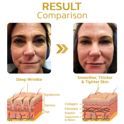 GFOUK™ PeptiDew Korean Peptide Deer Bone Soluble Collagen Film