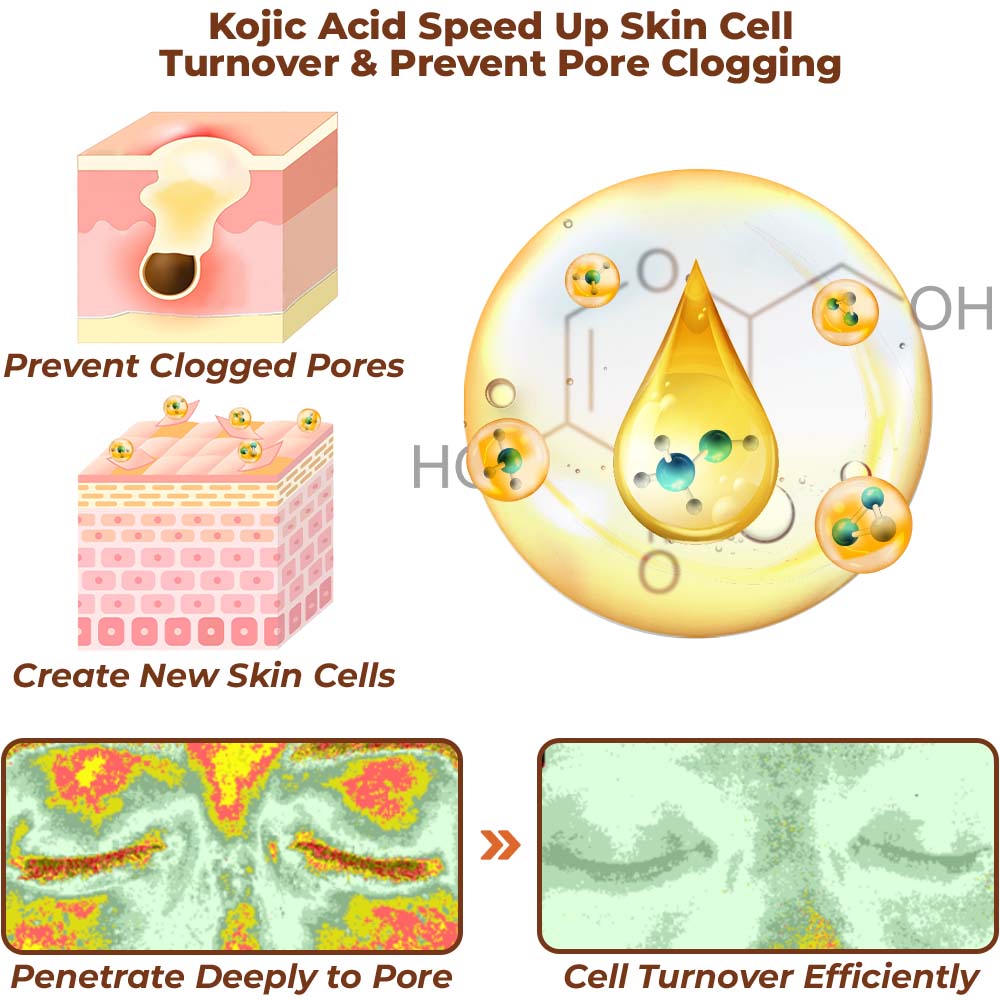 flysmus™ Milk Spots Treatment Essence