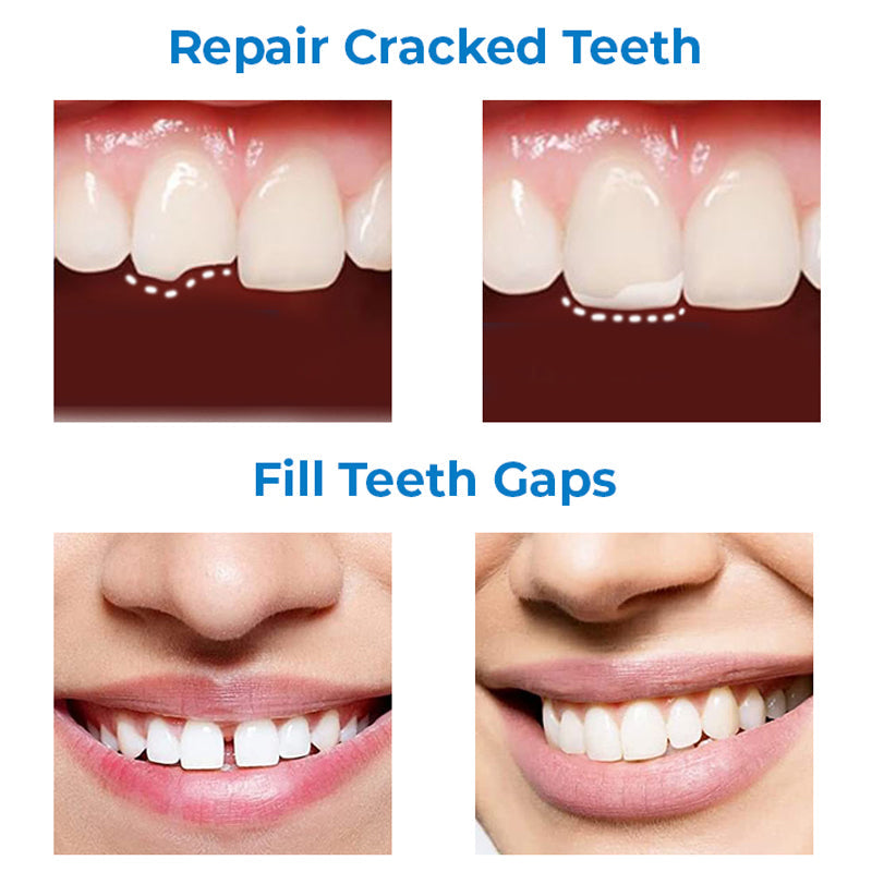 MEHARRY Tooth Repair Shaping Teether Kit