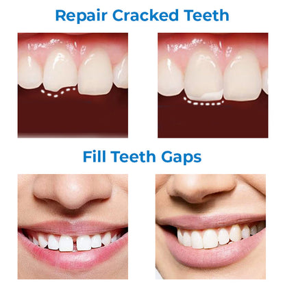MEHARRY Tooth Repair Shaping Teether Kit